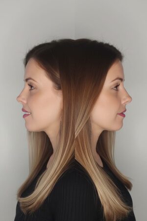Foto doble Foto doble